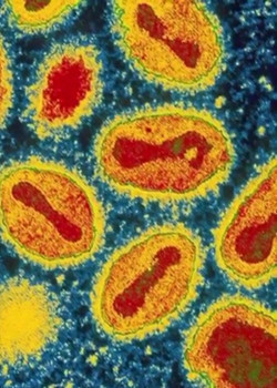 7 вирусов от которых может погибнуть человечество
