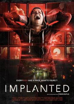 Имплант / Implanted